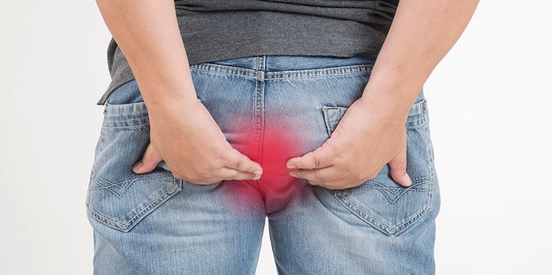 Doença Hemorroidária: como tratar os sintomas?