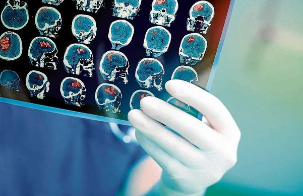 Número de AVC’s no distrito é preocupante